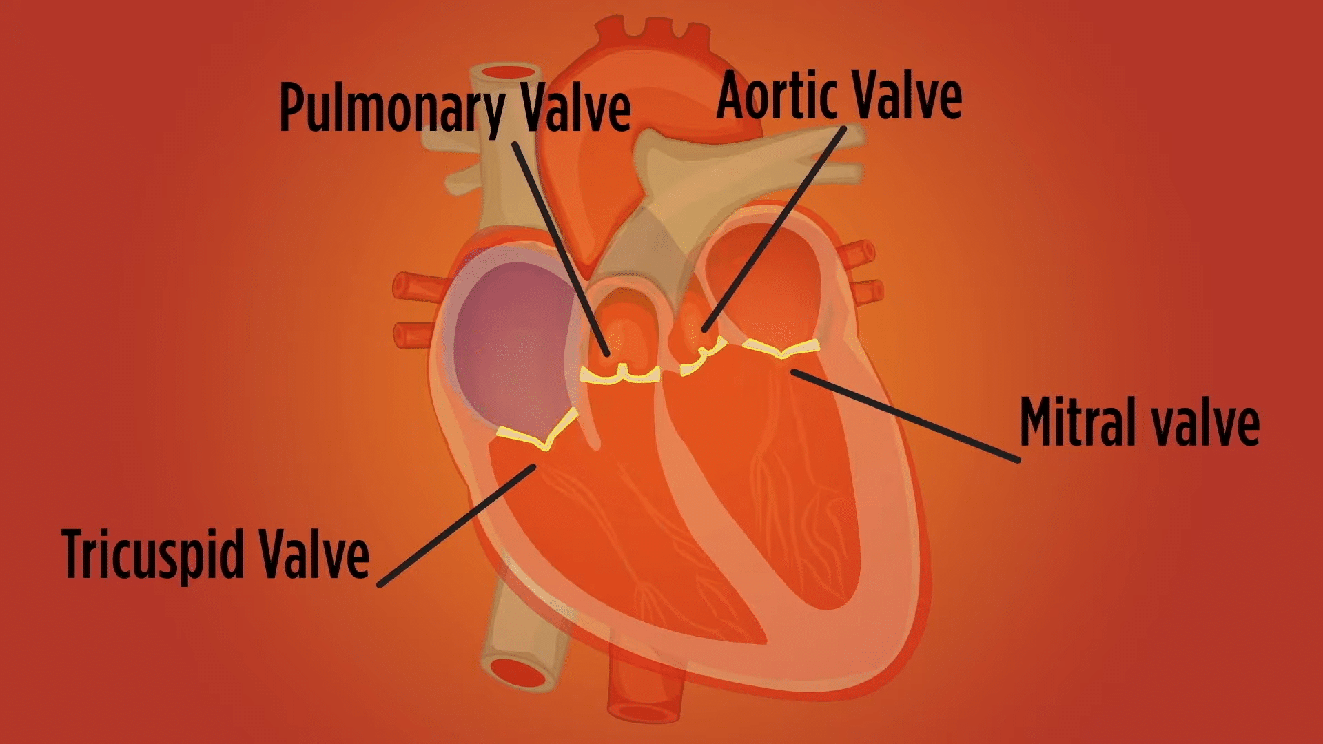 Illustration of the heart labeling pulmonary, aortic, mitral, and tricuspid valves.