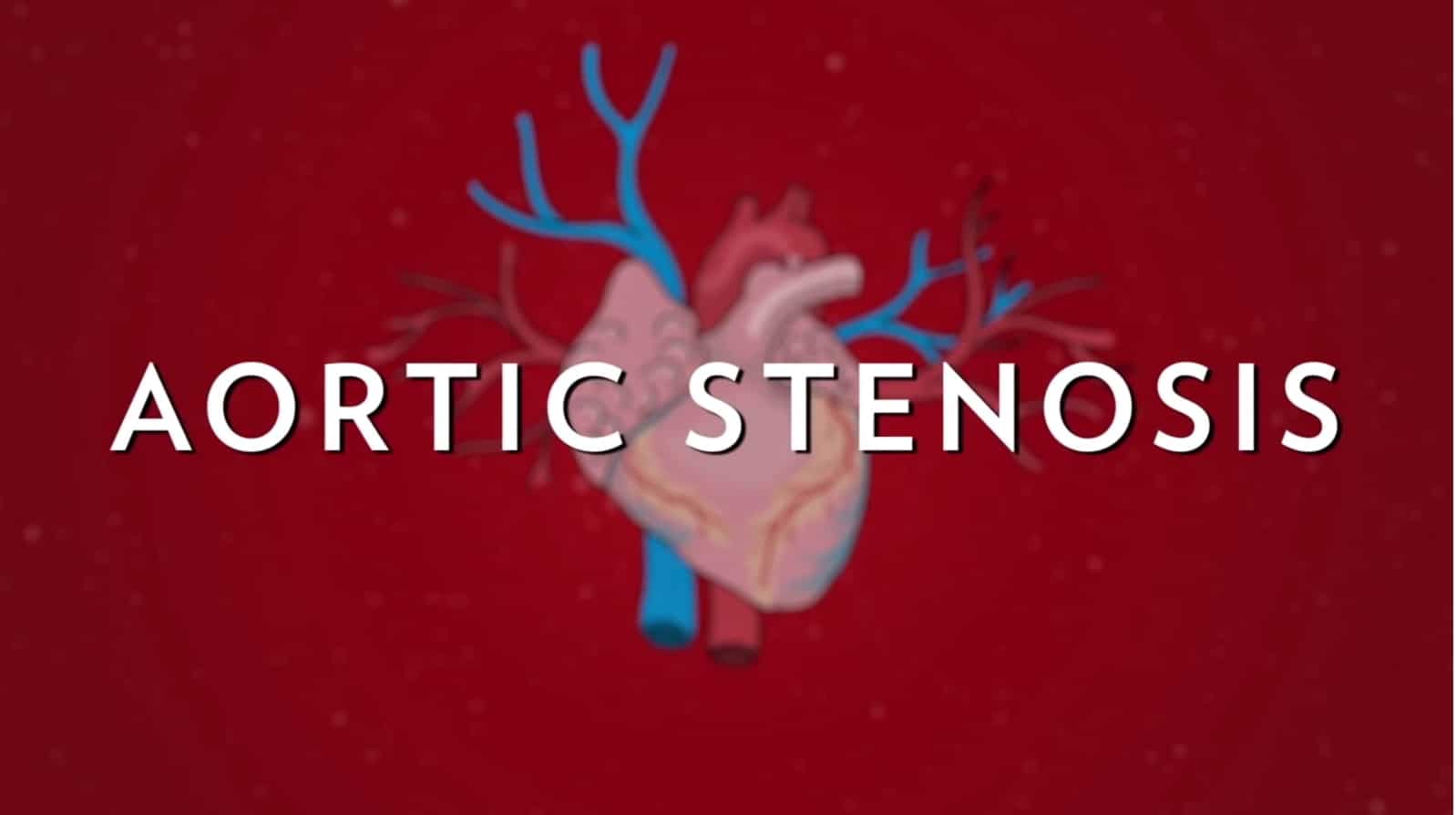 "Aortic Stenosis in Seniors Explained" video cover.