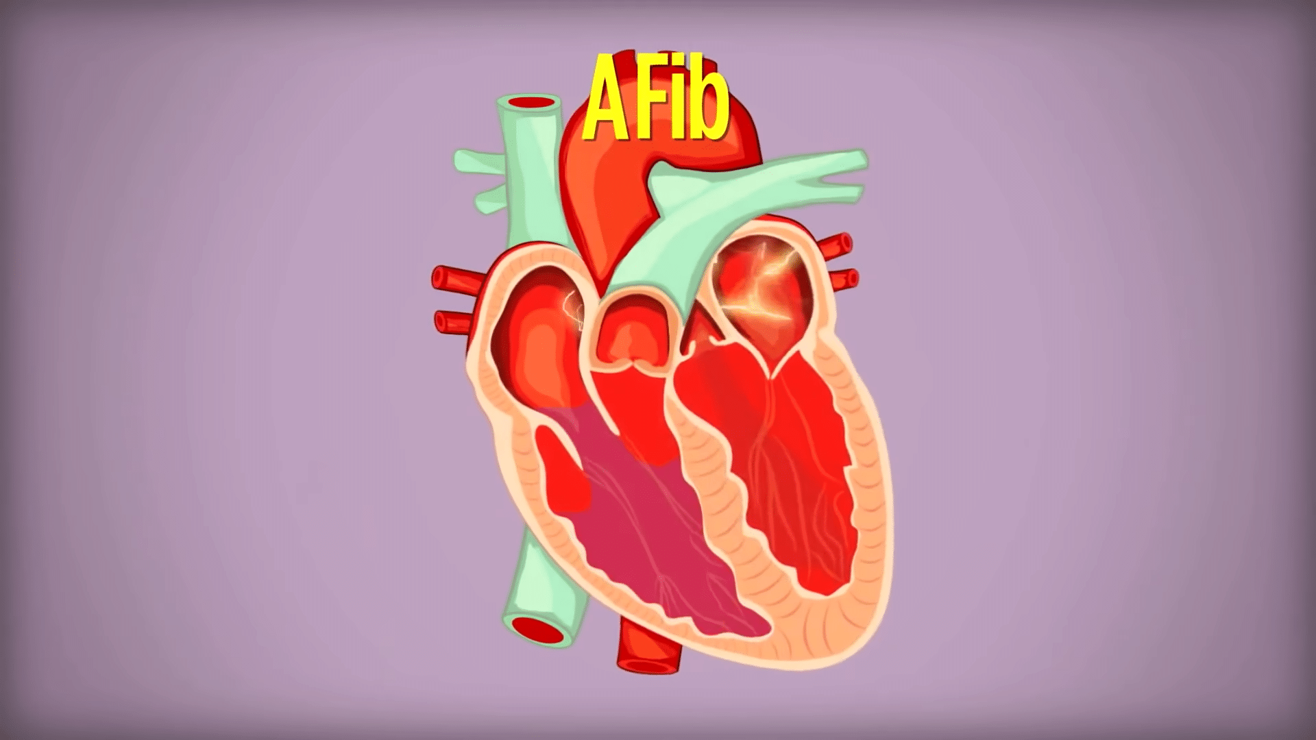 Cartoon anatomical heart.