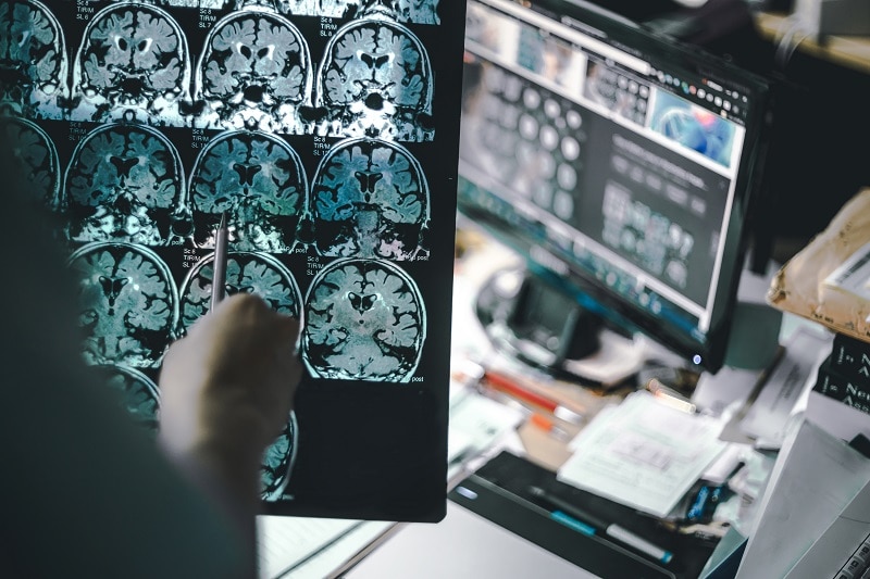 Researcher analyzing brain scans.